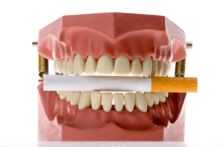 Prevención del cáncer oral Prevención del cáncer oral